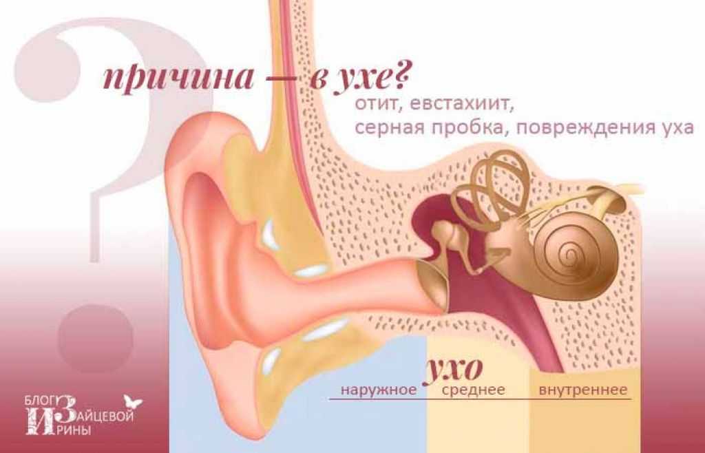 Пульсирующие закладывает уши. Шум в ухе причины. Шум звон в ушах причины.