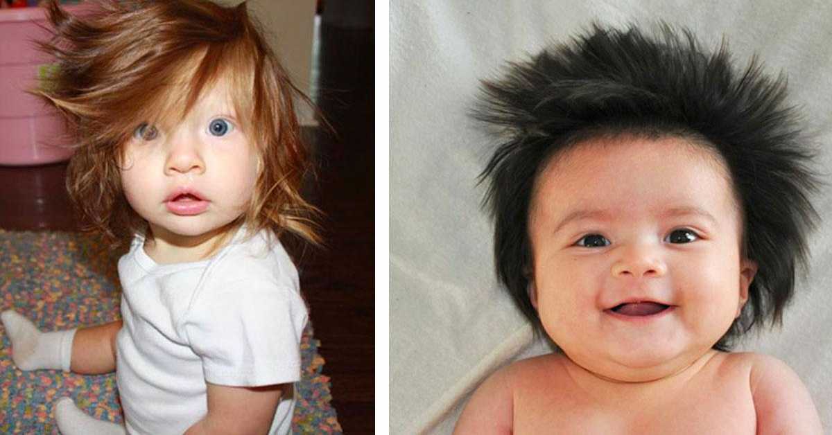 Родился без волос. Дети рождаются с волосами. Малыши с волосами рождаются. Младенец с торчащими волосами. Дети рождённые с волосами.