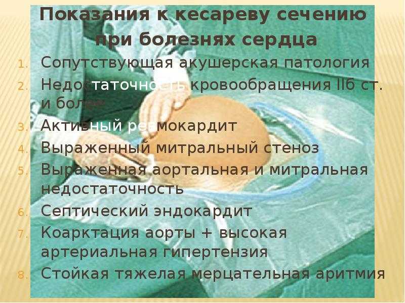 Кесарево сечение показания при беременности плюсы