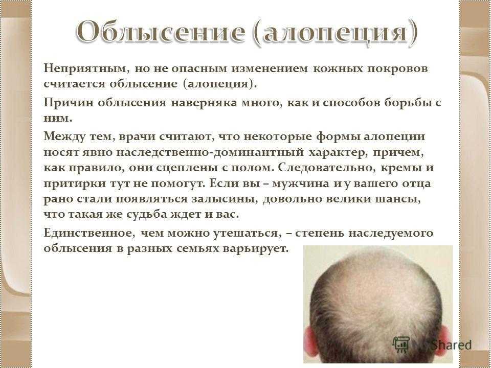Отзывы врачей выпадение волос. Заболевание волос алопеция. Себорейная алопеция у детей. Почему у ребенка выпадают волосы на голове.