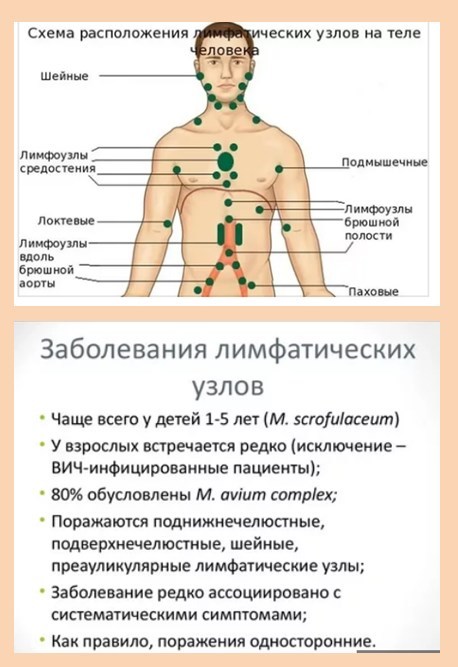 Лимфатические узлы на теле человека фото