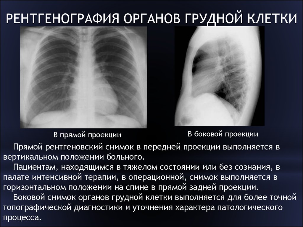 План описания рентгенограммы легких