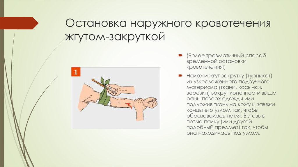 Презентация на тему способы остановки кровотечения