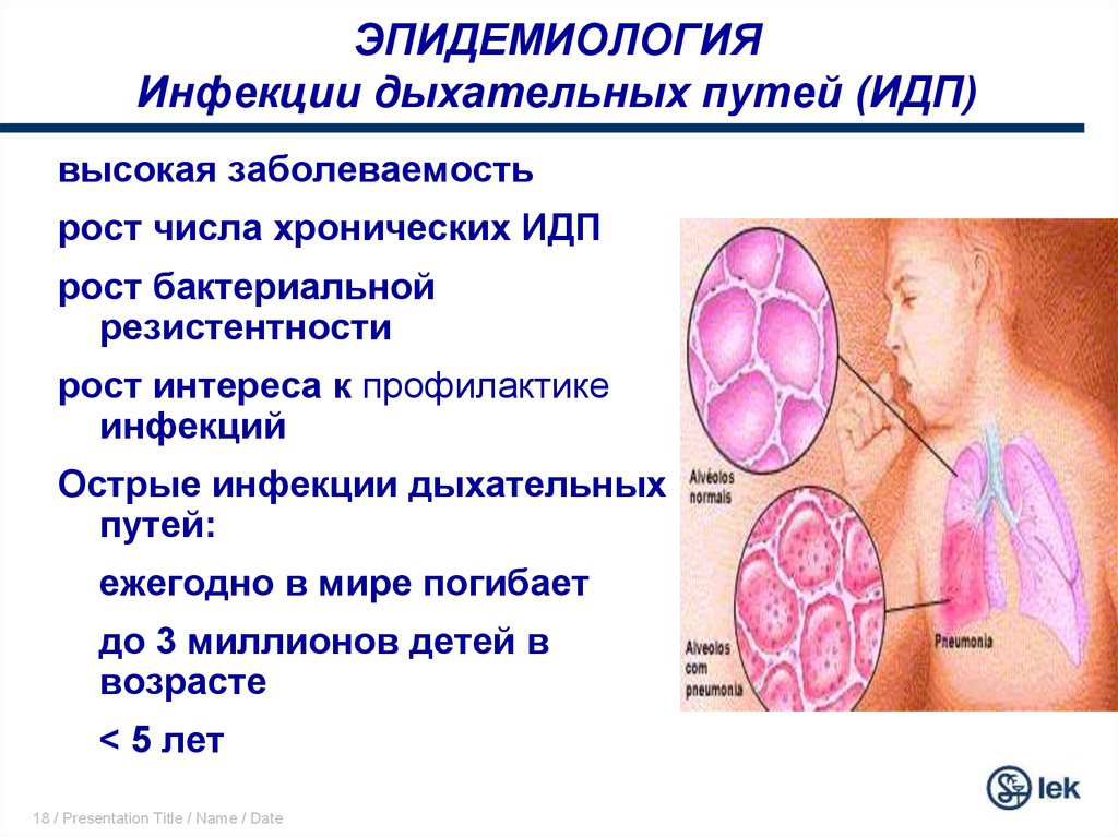 Респираторные заболевания. Инфекции дыхательных путей эпидемиология. Эпидемиология и профилактика инфекций верхних дыхательных путей. Эпидемиологическая характеристика инфекций дыхательных путей. Эпидемиология антропонозных инфекций дыхательных путей.