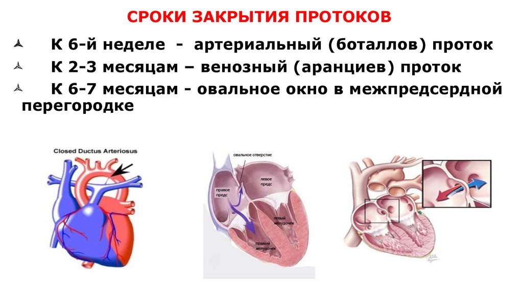 Закрытие артериального протока происходит