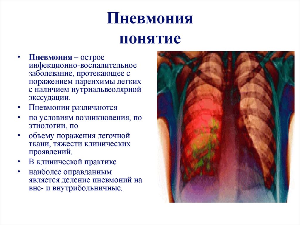 Лекарственное поражение легких презентация