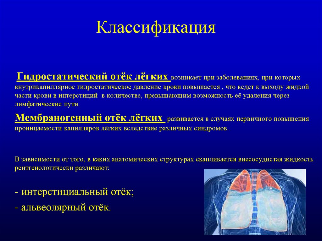 Отек легких. Отек легких классификация. Отёк лёгких классификация. Гидростатический отёк лёгких. Отек легкого классификация.