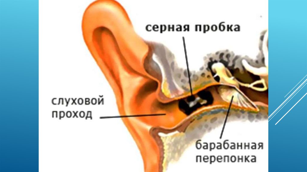 Картинки ушная сера