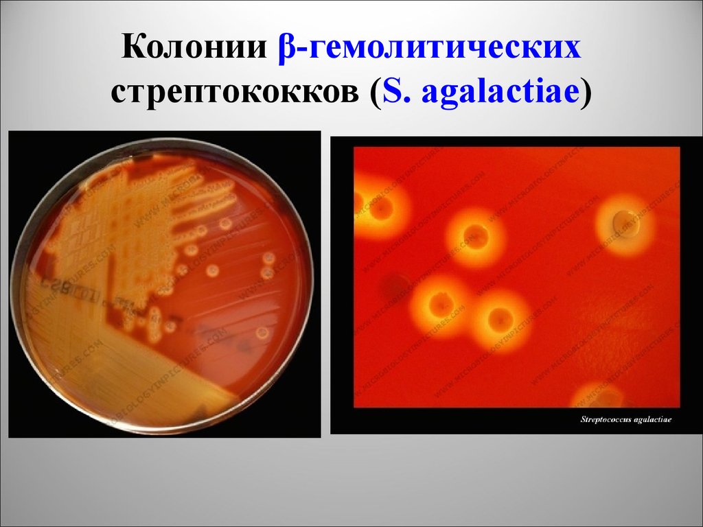 Стрептококков стафилококков. Гемолитический стрептококк pyogenes. Альфа и бета гемолитические стрептококки. Альфа гемолитический стрептококк. Колонии бета-гемолитического стрептококка.