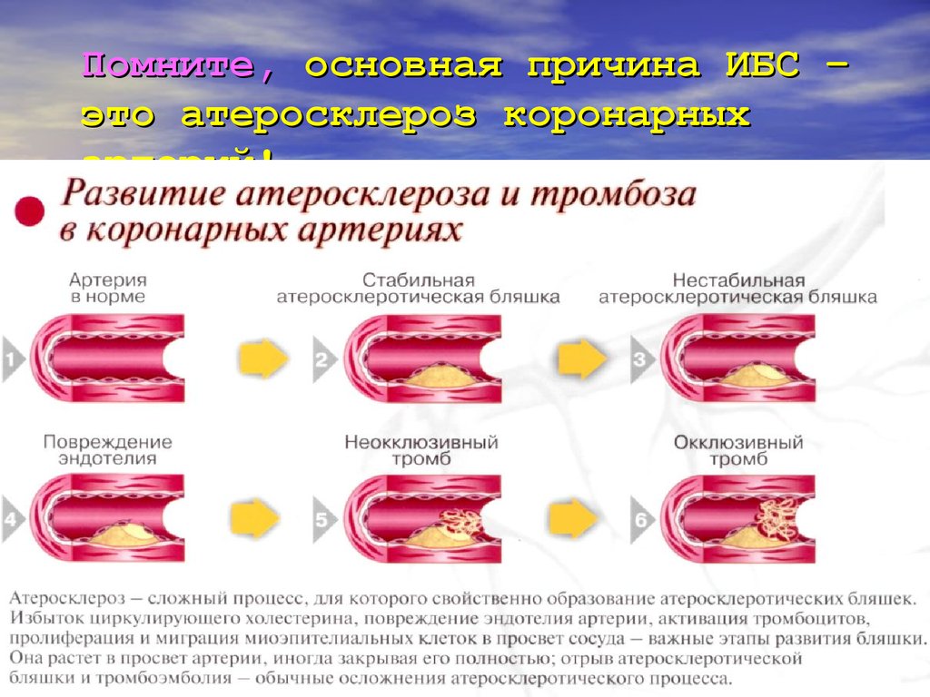 Атеросклероз артерий сердца