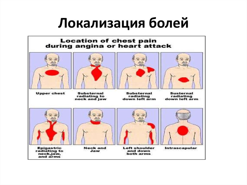 Какие боли при пневмонии. Локализация боли в груди. Локализация боли в грудной клетке. Локализация сердечных болей. Локализация боли в сердце.