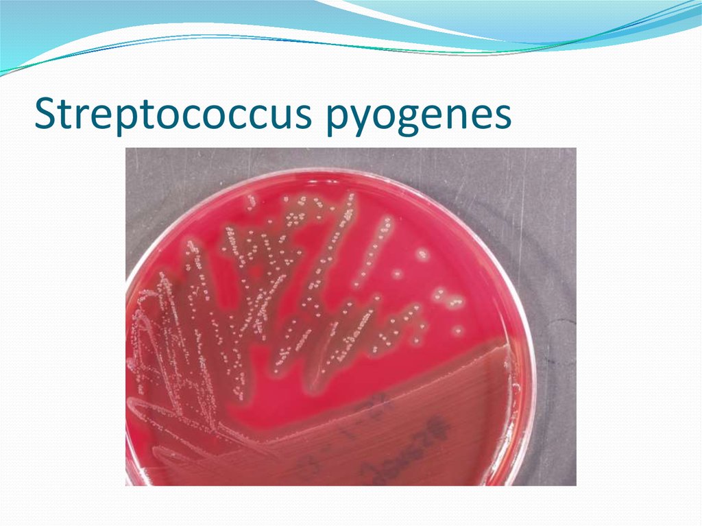 Streptococcus agalactiae у мужчин. Пиогенные стрептококки. Пиогенный стрептококк группы а. Пиогенный стрептококк Петри. Пиогенный стрептококк возбудитель.