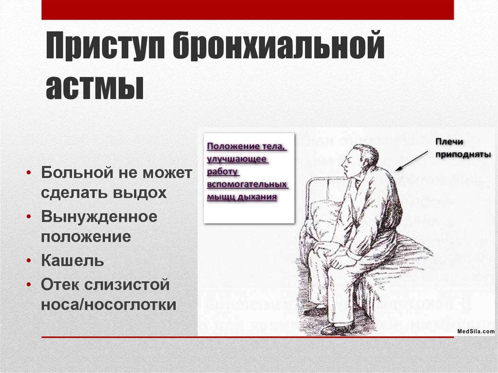 Для аускультативной картины во время приступа бронхиальной астмы наиболее характерно наличие