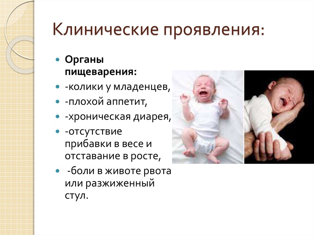 Колики проявление. Причины Колик у новорожденных. Статистика Колик у новорожденных. Младенческая колика психосоматика. Младенческие колики критерии.