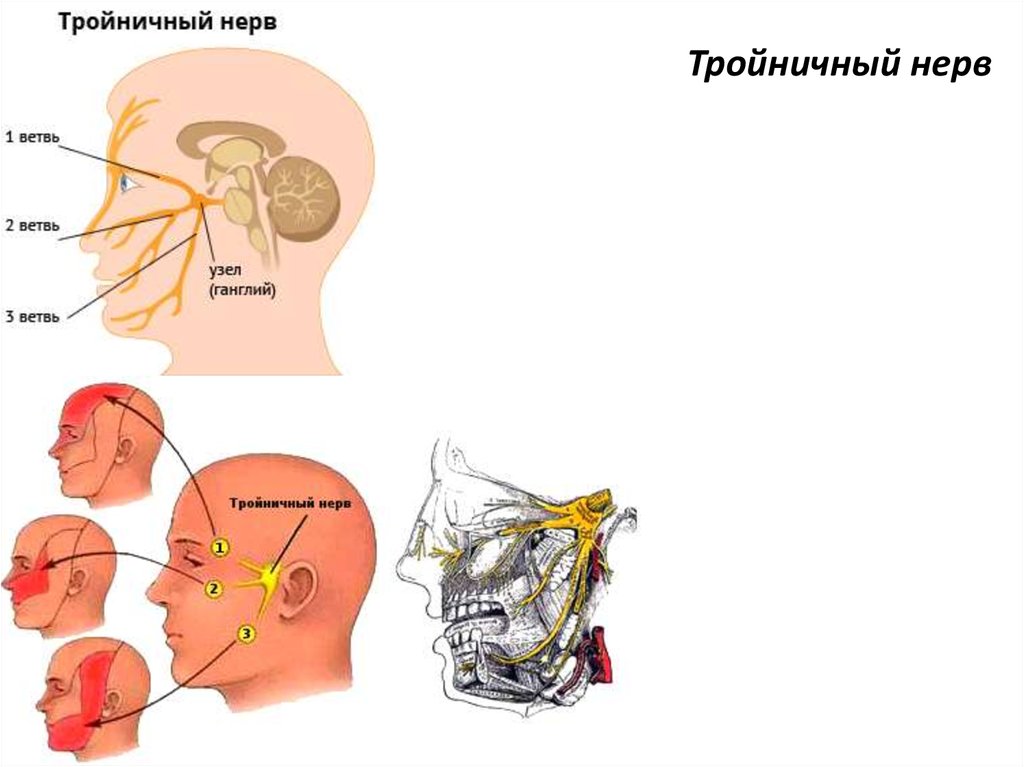 Воспаление тройничного лицевого нерва. Неврология 3 ветви тройничного нерва. Симптомы поражения тройничного нерва.