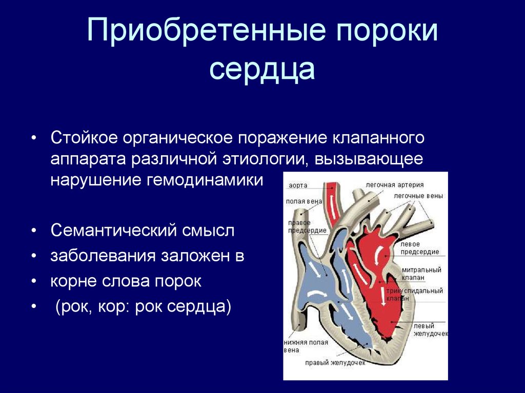 Порок сердца картинки