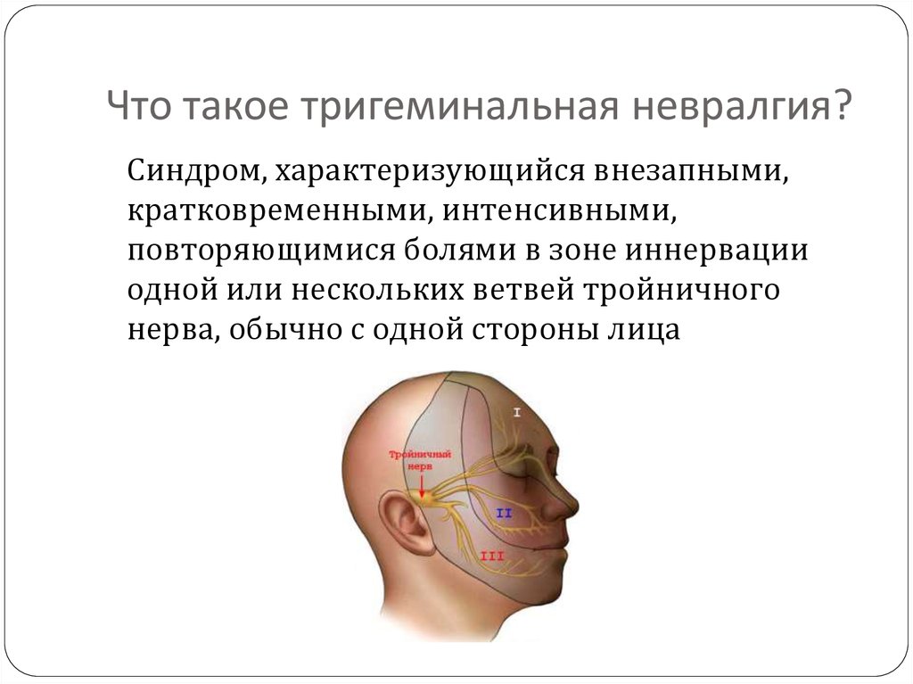 Троичный лицевой нерв воспаление лечение. Невралгия тройничного нерва лица. Невропатия тройничного нерва клиника. Невралгия тройничного нерва (тригеминальная невралгия). Герпес 1 ветви тройничного нерва.