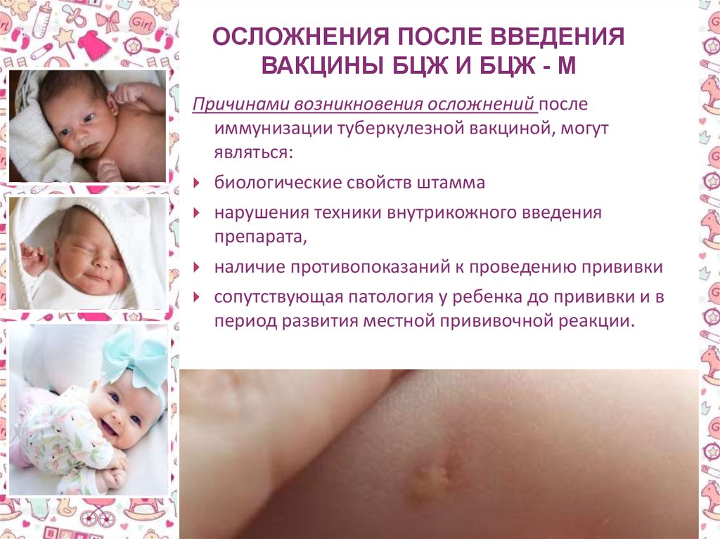 Массаж после прививки можно. Папула БЦЖ новорожденный. Как выглядят прививки. Реакция на Введение вакцины БЦЖ. Осложнения БЦЖ вакцинации.