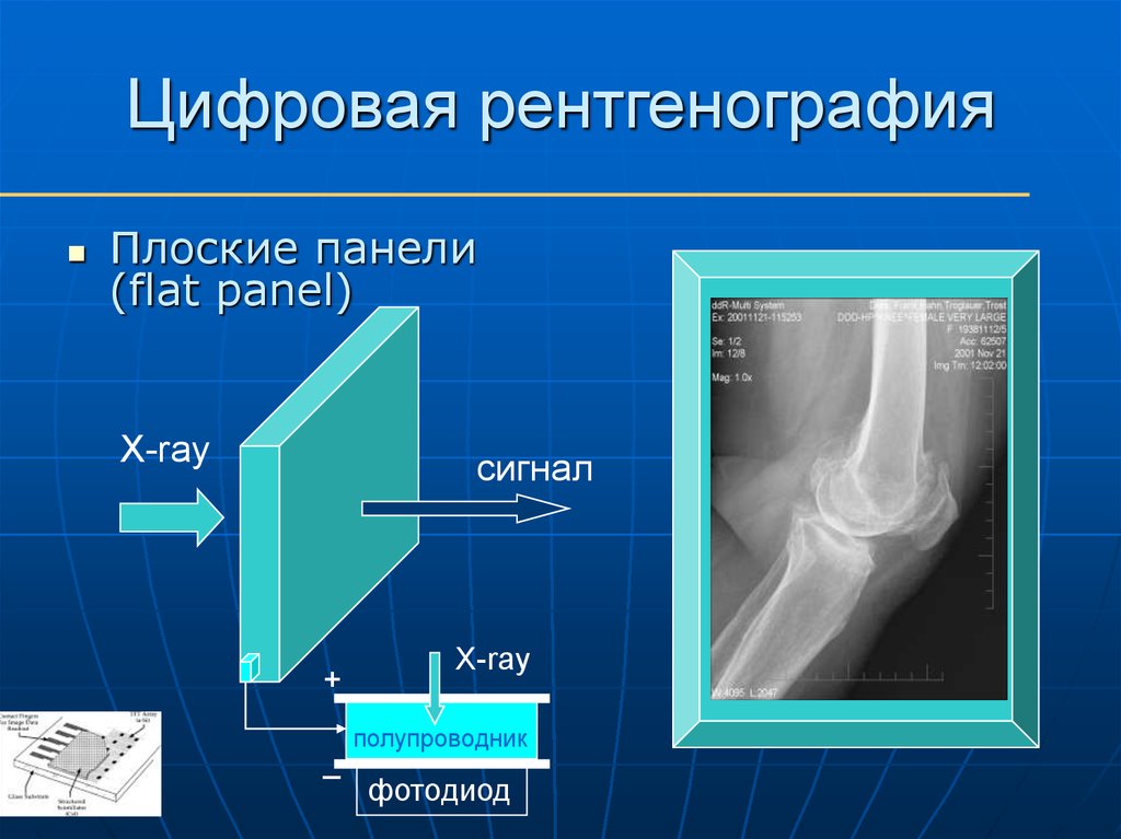 Рентгеновское изображение получают