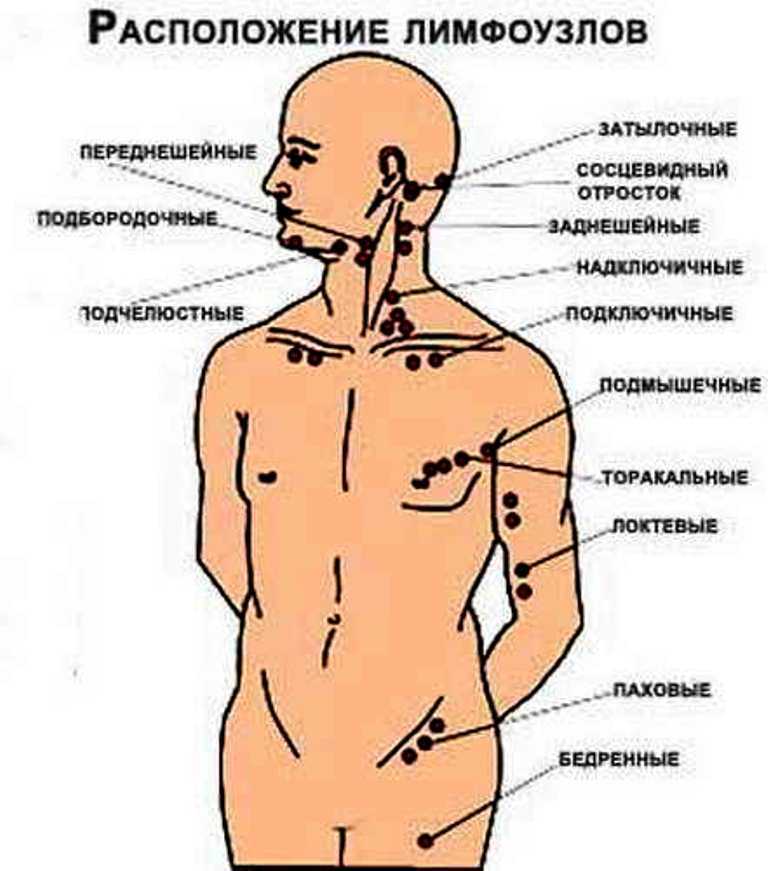 В каком месте лимфоузлы. Лимфатические узлы человека схема расположения. Лимфатические узлы на теле человека схема у мужчин. Где находятся лимфатические узлы у человека фото. Схема лимфоузлов на теле человека на шее.