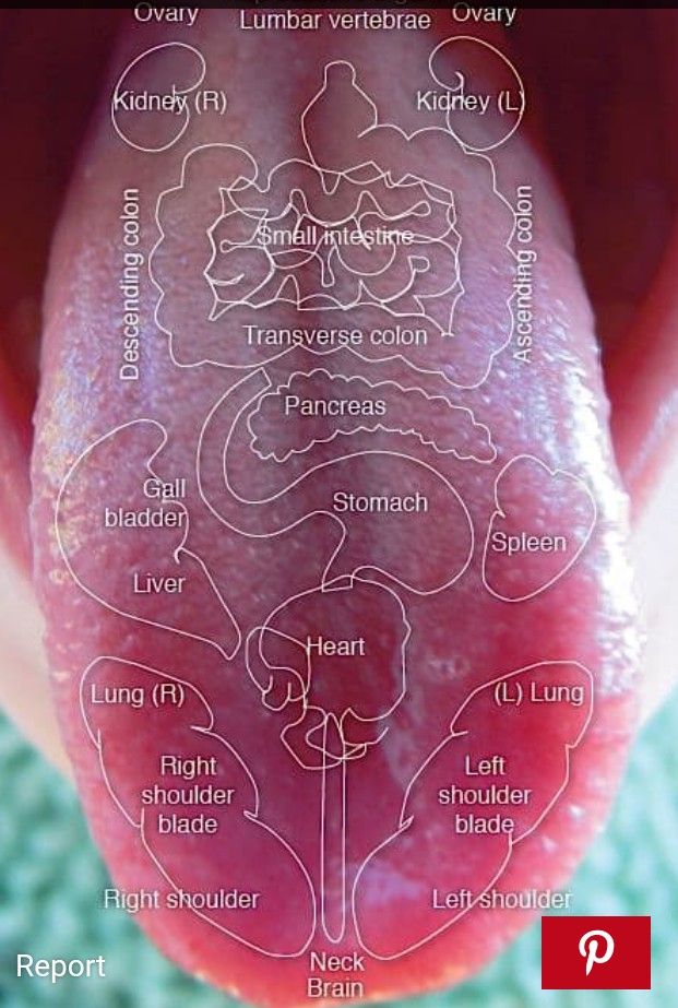 О чем говорит цвет языка о каких заболеваниях в картинках