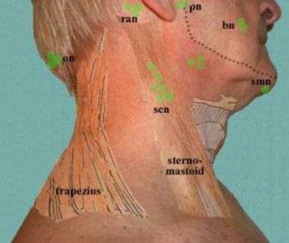 Где Располагаются Лимфоузлы На Шее Фото