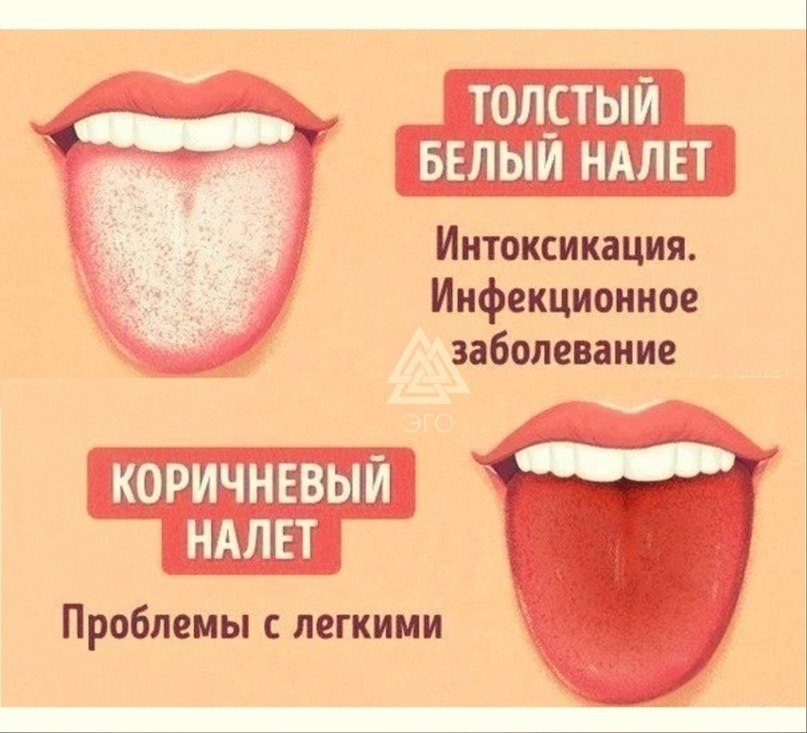 Цвет языка