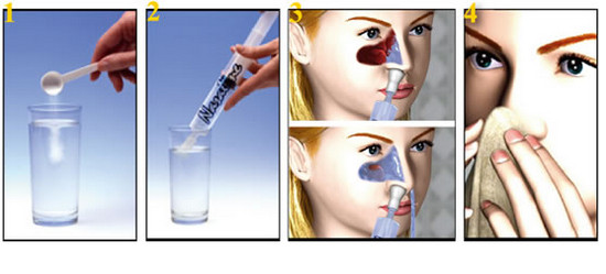 Как правильно промыть нос физраствором из шприца