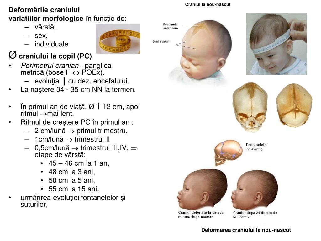Роднички таблица. Форма головы новорожденного. Форма головы младенца норма. Формы черепа у новорожденных. Форма головы у новорожденных норма.