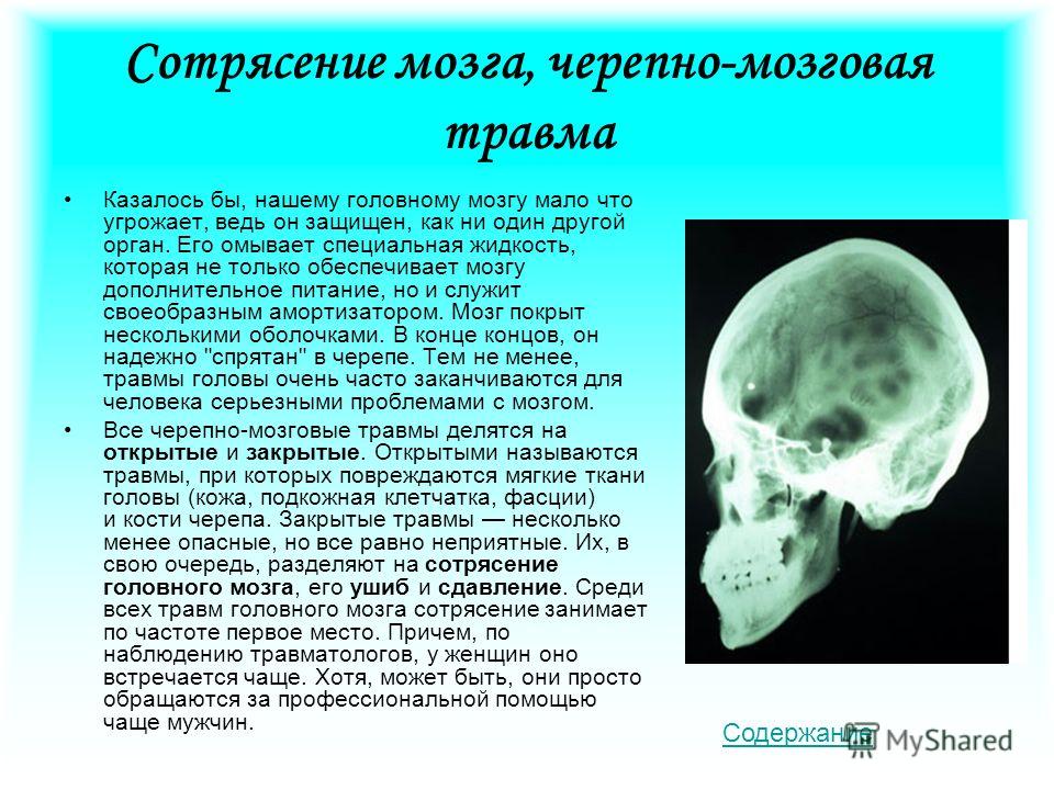 Сотрясение головного мозга презентация