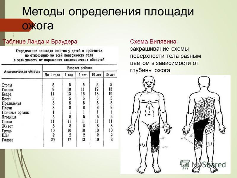 Ожоги проценты поражения. Методы определения поражения площади ожога. Методы оценки площади ожога. Метод измерения площадь ожогов. Подсчет площади ожоговой поверхности.