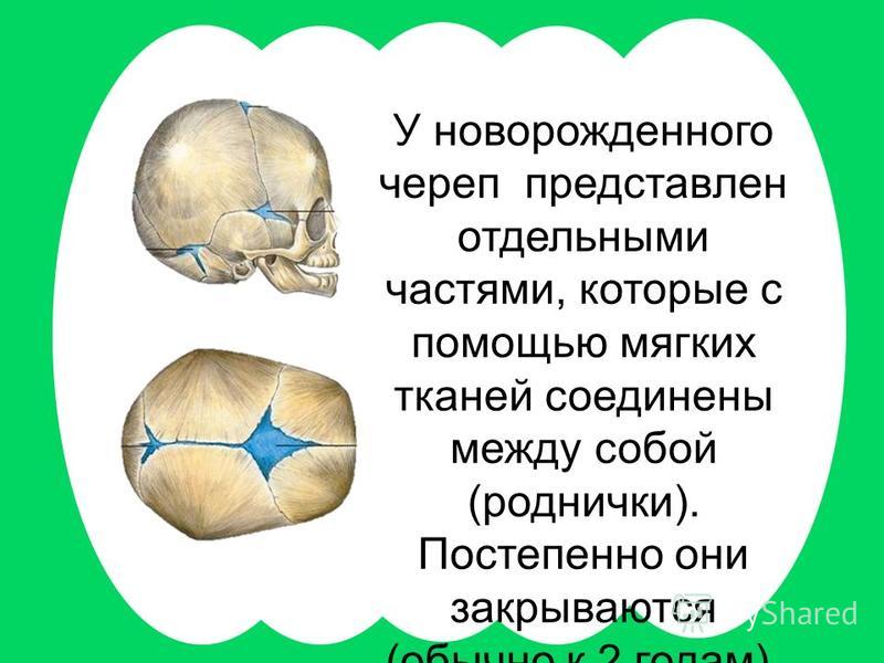 Родничок у малыша. Роднички новорожденного анатомия черепа. Кости черепа роднички.