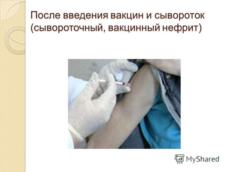 Анатомические области введения вакцин