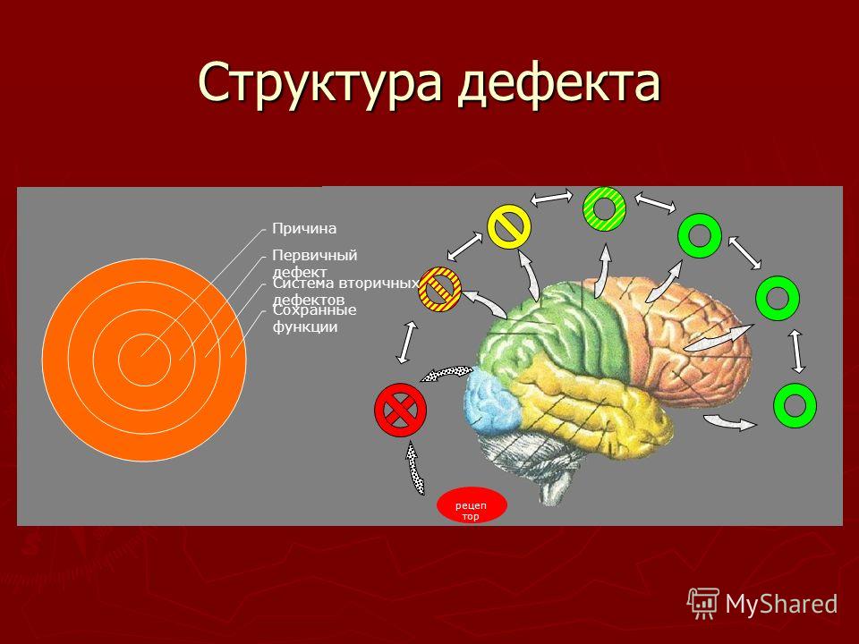 Структура дефекта при нарушении слуха схема