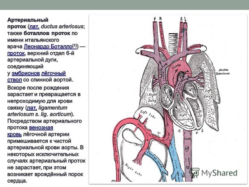 Легочный ствол картинка