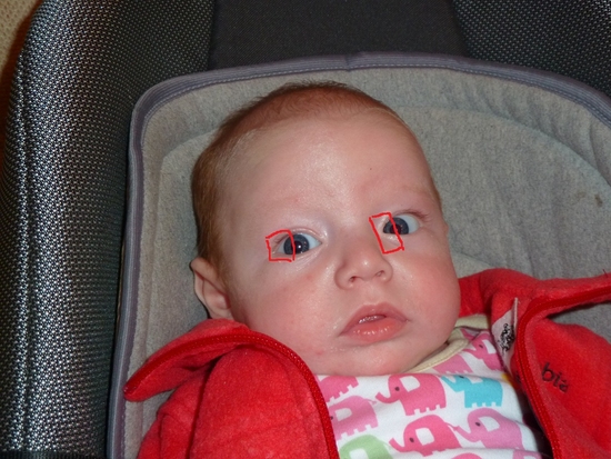 Ребенок косит глазки. Косоглазие у грудничков. Косоглазие глаза у грудничка. Комят глаза у новорожденного.