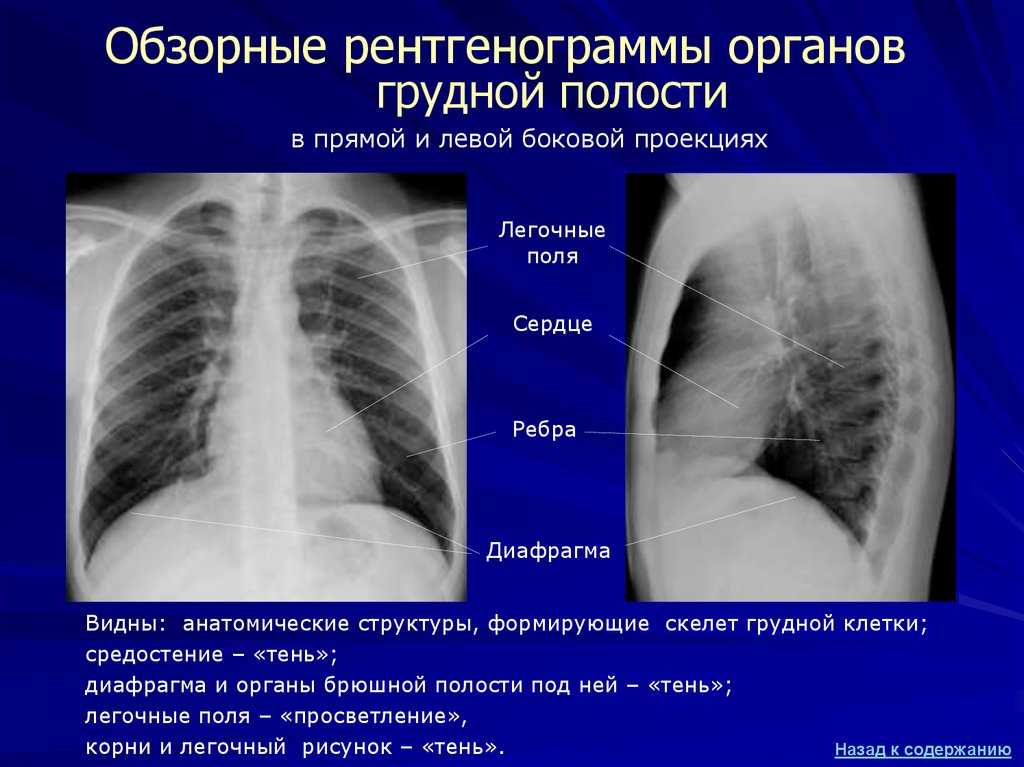 Укладки в рентгенологии в картинках и с описанием