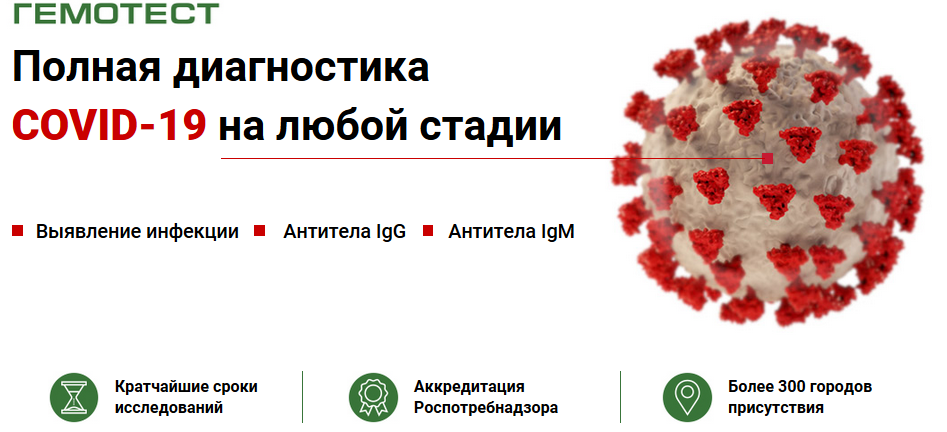 Сдать тест новосибирск. Кровь на антитела коронавирус. Гемотест антитела. Тест на ковид исследование. Covid-19 анализы крови.