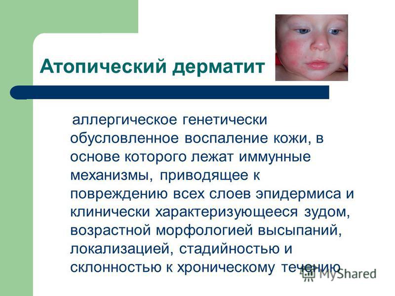 Атопич. Атопический дерматит у детей. Аллергический дерматит у детей. Атопический дерматит аллергический у детей. Fnjgbxtcrbq lthvfnnbn e ltntq.