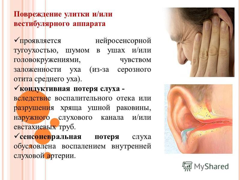 Что делать если заложило левое ухо. Шум звон в ушах причины. Причины возникновения шума в ушах. Шум в ушах и ухудшение слуха. Симптомы ушах звенит.