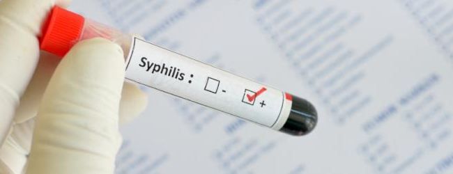 Серологические анализы крови на сифилис