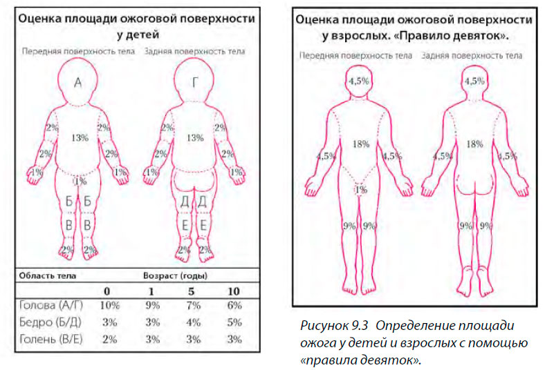 Ожог 2 степени карта вызова