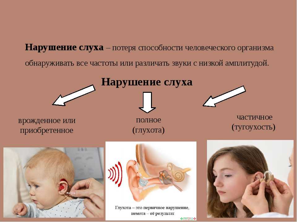 Презентация слабослышащих. Нарушения слуха и глухота. Причины нарушения слуха. Причины развития нарушений слуха. Причины нарушения и ослабления слуха.