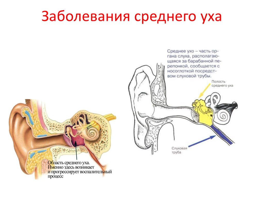 Нарушение среднего уха. Заболевания внутреннего уха таблица. К заболеваниям внутреннего уха относится:. К заболеваниям среднего уха относятся.