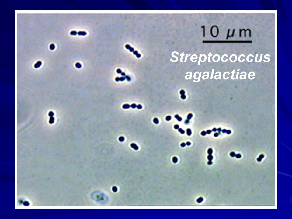 Стрептококк при беременности. Streptococcus agalactiae в мазке. Микроорганизмы стрептококк  agalactiae. Стрептококк агалактия в мазке. Streptococcus agalactiae гр.в в моче.