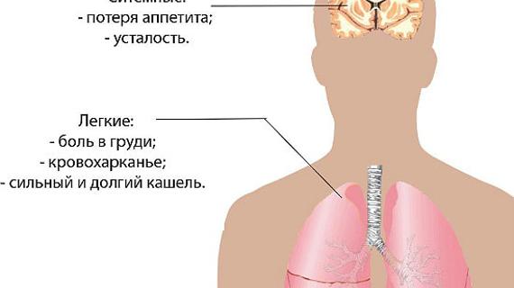 Боль в легких. Как понять что болят легкие а не спина.