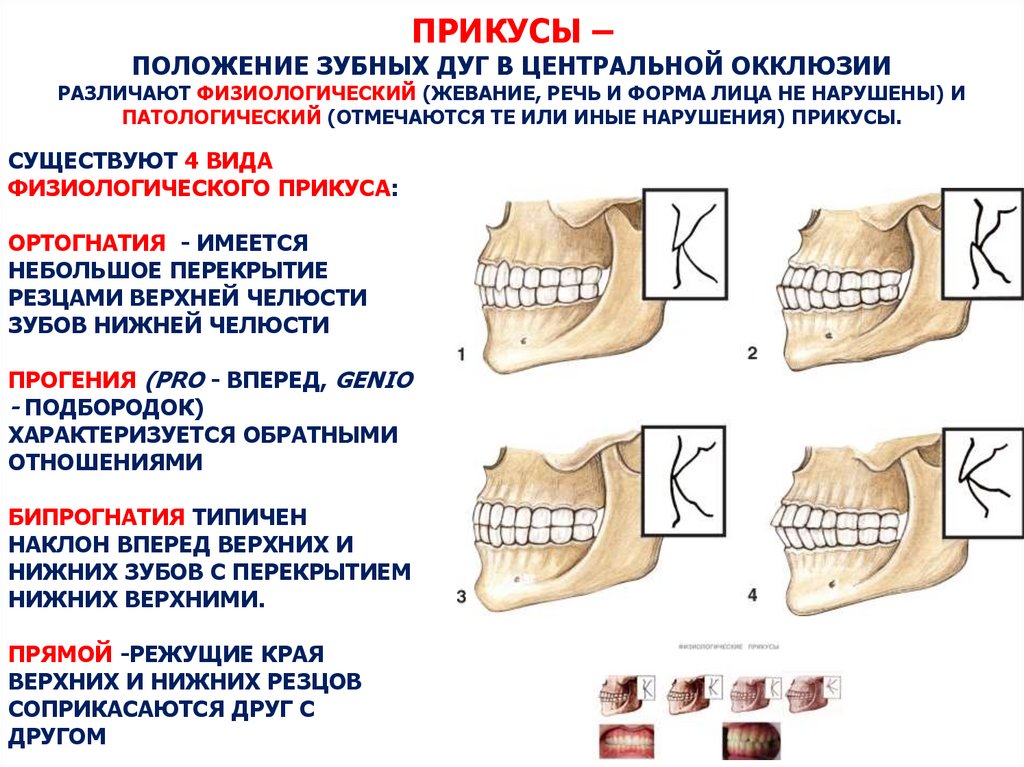 Оперативное лечение при аномалиях и деформациях верхней челюсти презентация