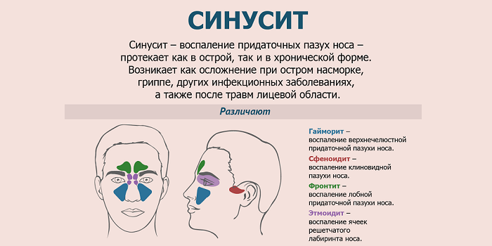 Синусит можно греть нос