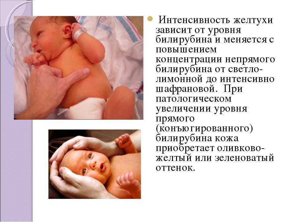 Ребенок желтуха почему. Желтуха новорожденных показатели билирубина в первые дни. Причина желтушки у новорожденного. Показатели желтухи у новорожденных норма. Норма билирубина у новорожденного ребенка.