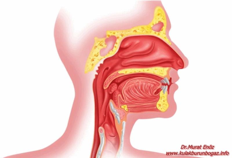 Колокольчик в горле. Острый катаральный ринофарингит. Болезни носоглотки и верхних дыхательных путей. Задняя стенка носоглотки.